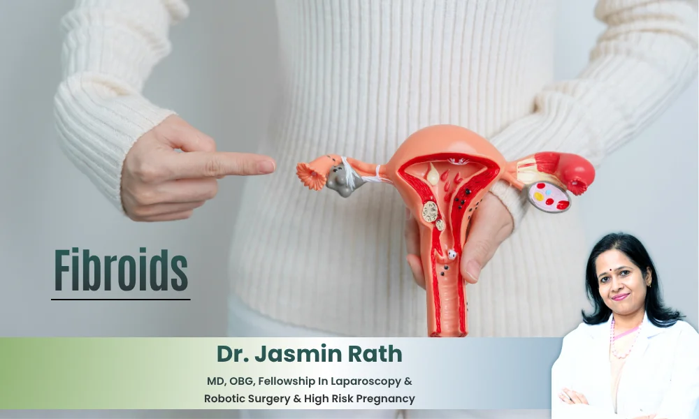 Best Fibroids Treatment in Jubilee Hills – Dr. Jasmin Rath